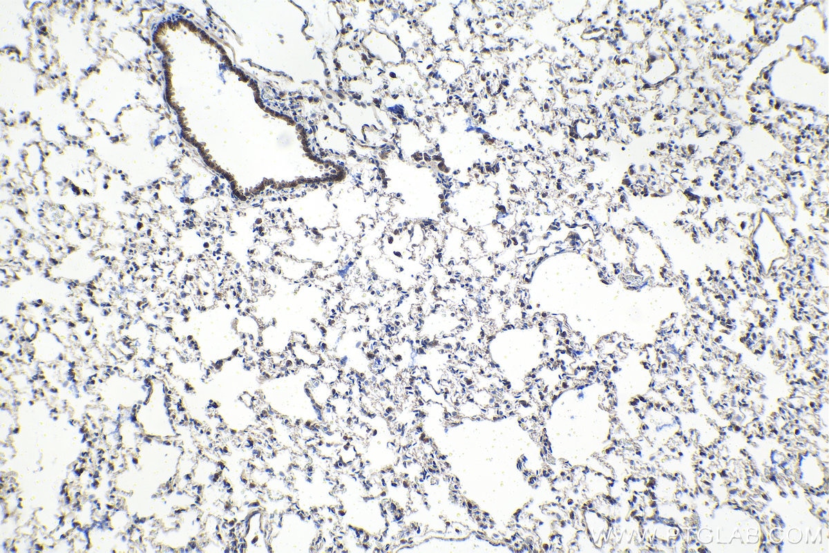 Immunohistochemical analysis of paraffin-embedded rat lung tissue slide using KHC1505 (ANG IHC Kit).