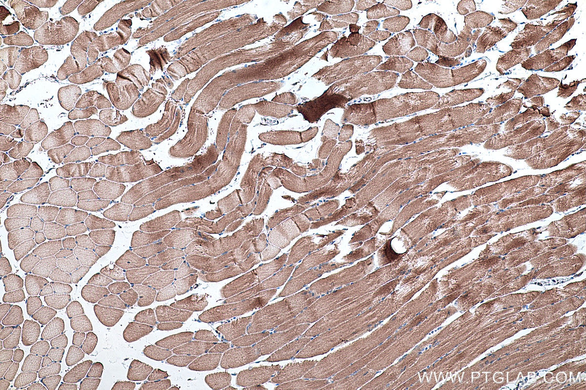 Immunohistochemical analysis of paraffin-embedded mouse skeletal muscle tissue slide using KHC0331 (ANKRD2 IHC Kit).