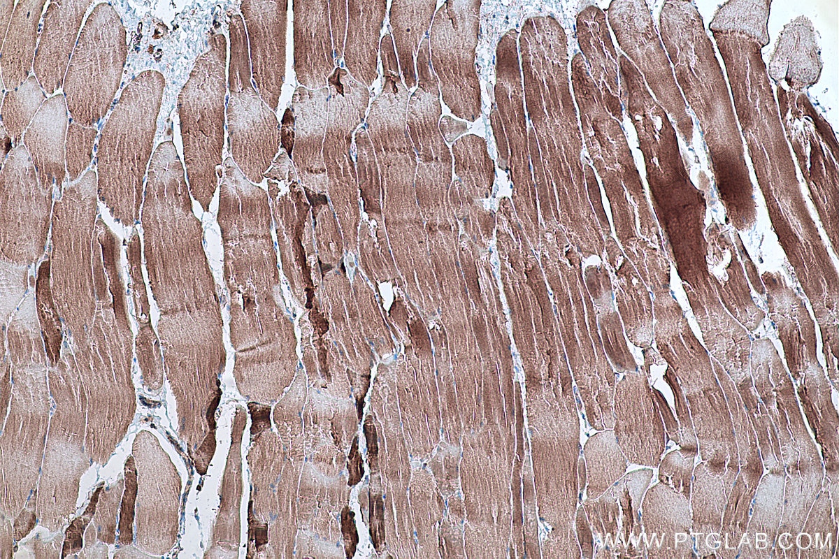 Immunohistochemical analysis of paraffin-embedded rat skeletal muscle tissue slide using KHC0331 (ANKRD2 IHC Kit).