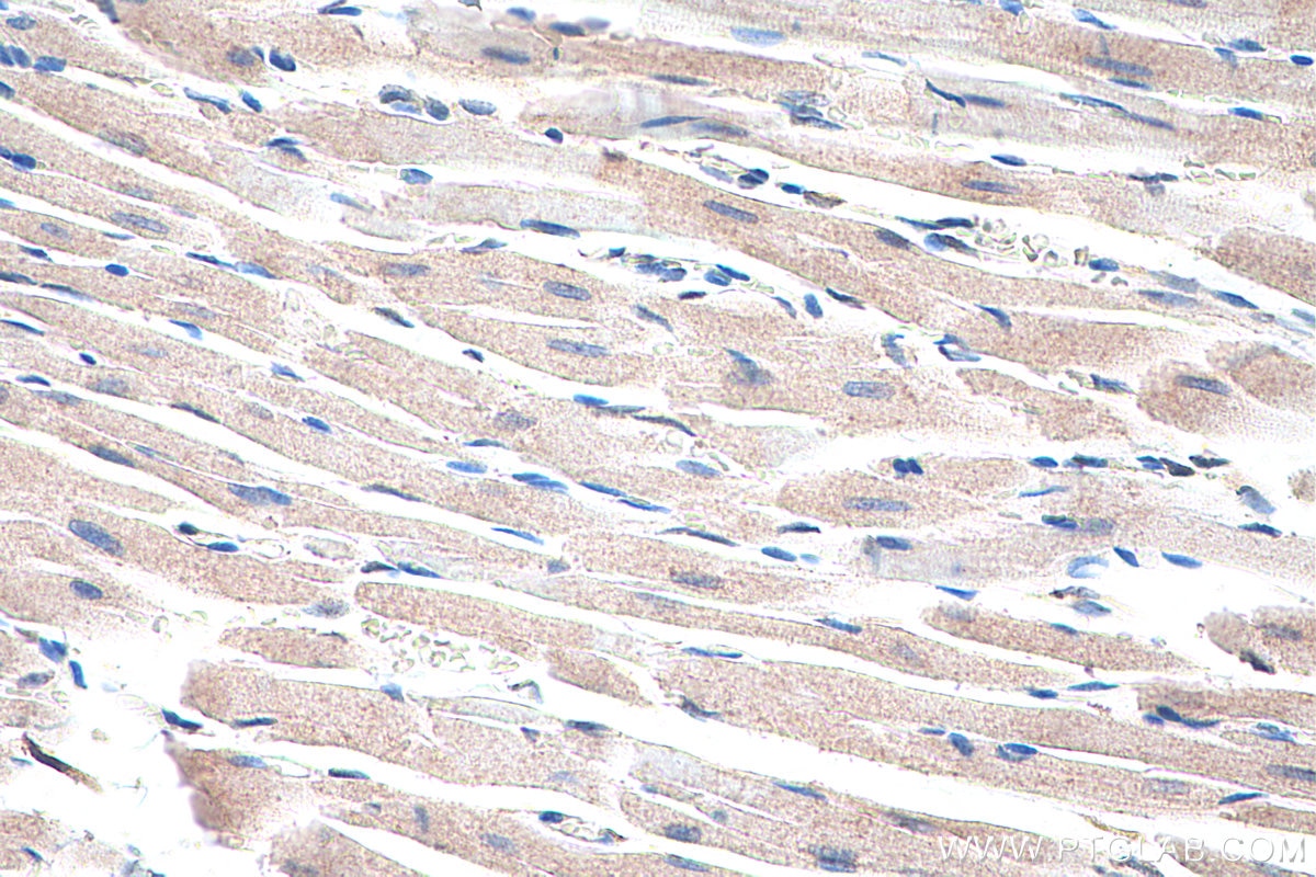 Immunohistochemical analysis of paraffin-embedded rat heart tissue slide using KHC0331 (ANKRD2 IHC Kit).