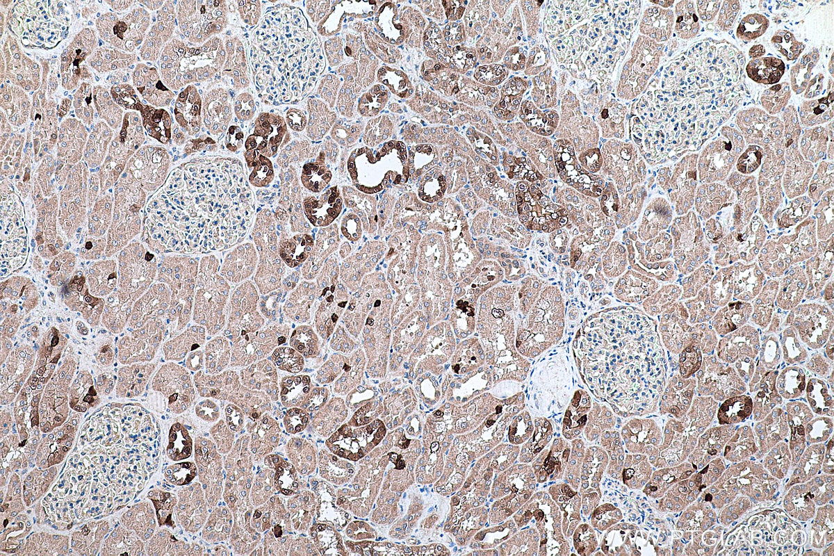 Immunohistochemical analysis of paraffin-embedded human kidney tissue slide using KHC0331 (ANKRD2 IHC Kit).