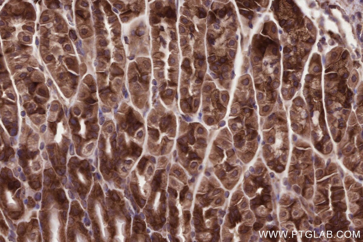 Immunohistochemical analysis of paraffin-embedded mouse stomach tissue slide using KHC2682 (ANKRD53 IHC Kit).