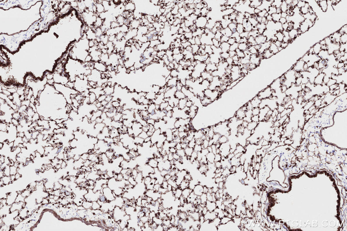 Immunohistochemical analysis of paraffin-embedded mouse lung tissue slide using KHC2682 (ANKRD53 IHC Kit).
