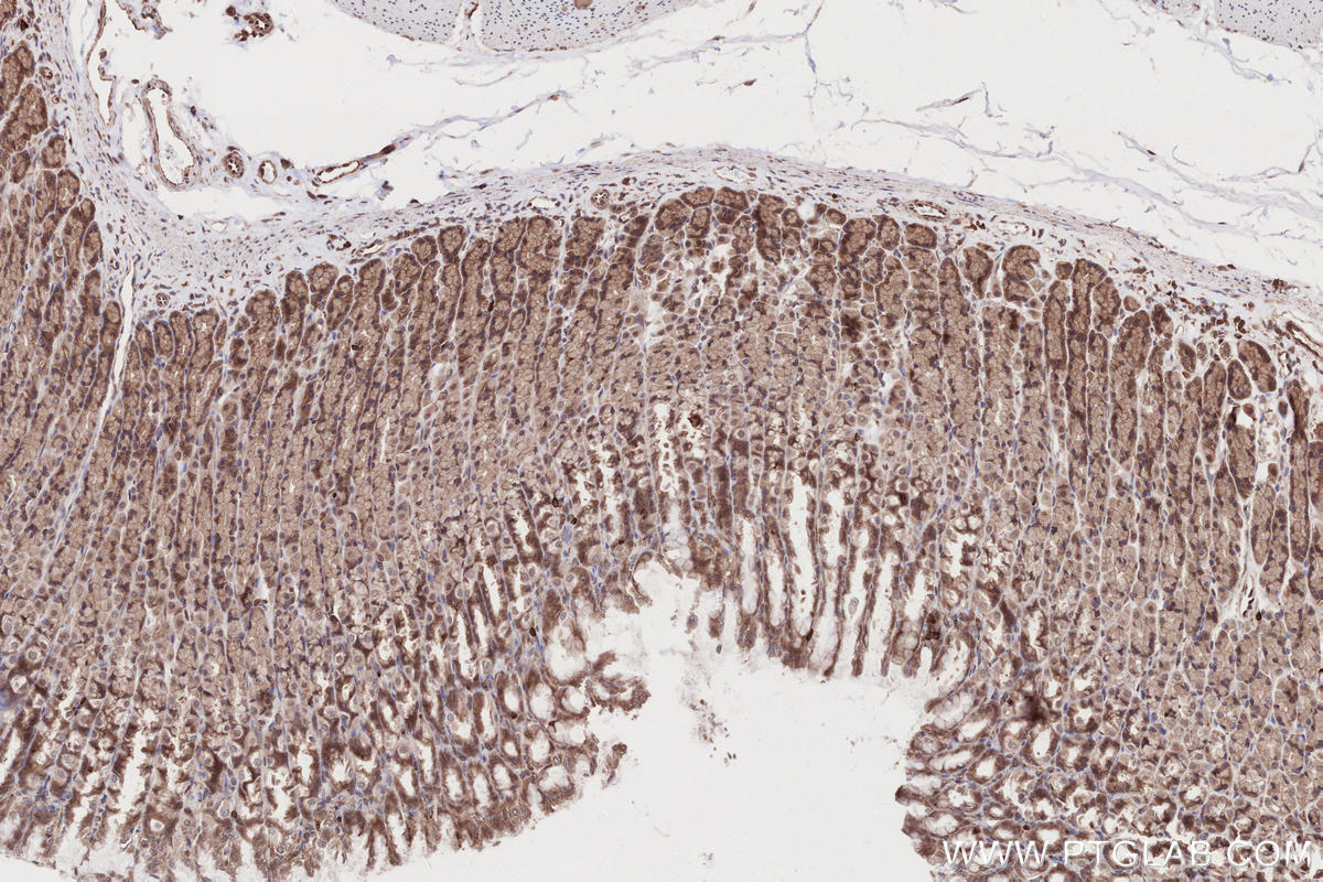 Immunohistochemical analysis of paraffin-embedded rat stomach tissue slide using KHC2682 (ANKRD53 IHC Kit).