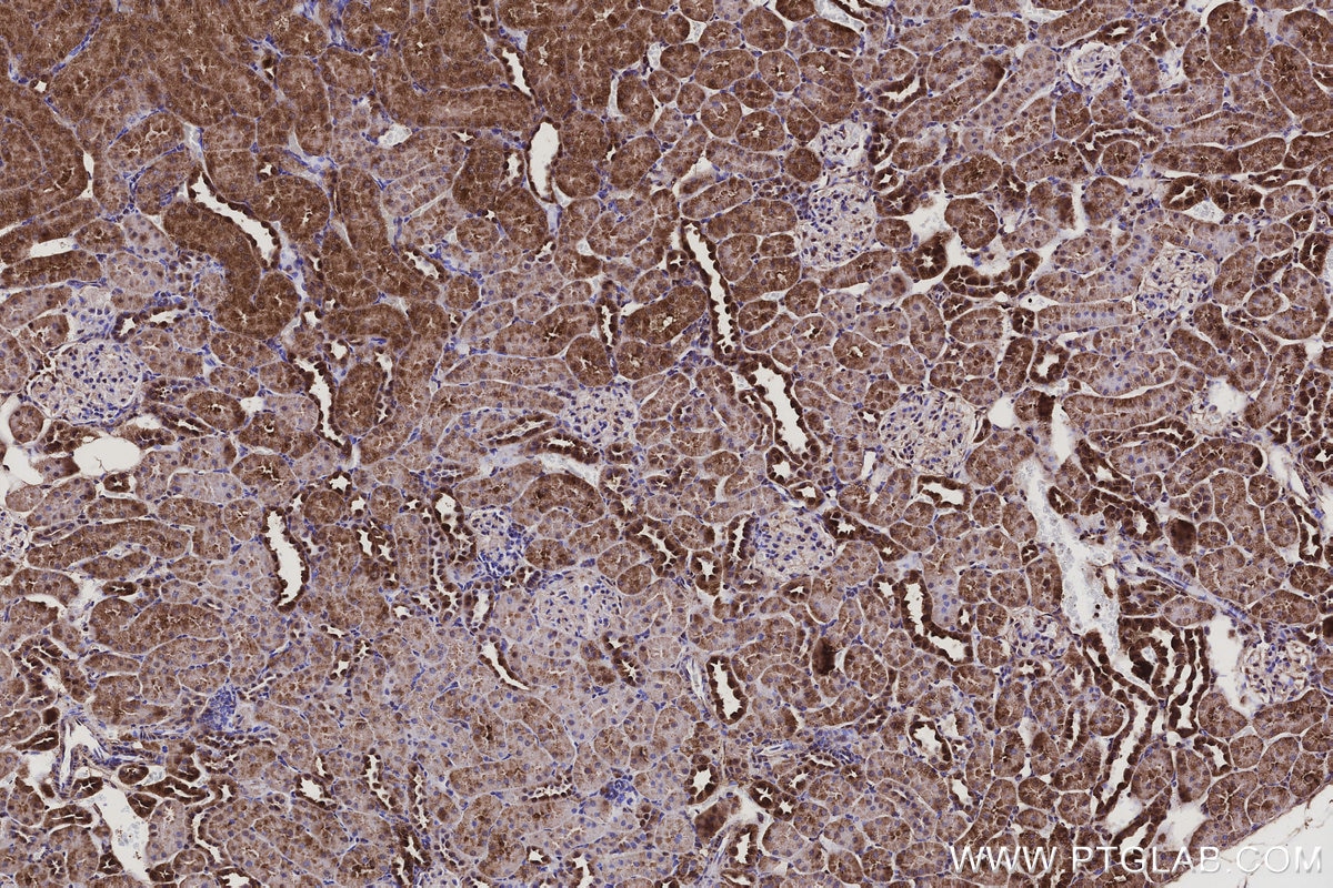 Immunohistochemical analysis of paraffin-embedded rat kidney tissue slide using KHC3104 (ANKRD54 IHC Kit). Immunohistochemical analysis of paraffin-embedded rat kidney tissue slide using KHC3104 (ANKRD54 IHC Kit).