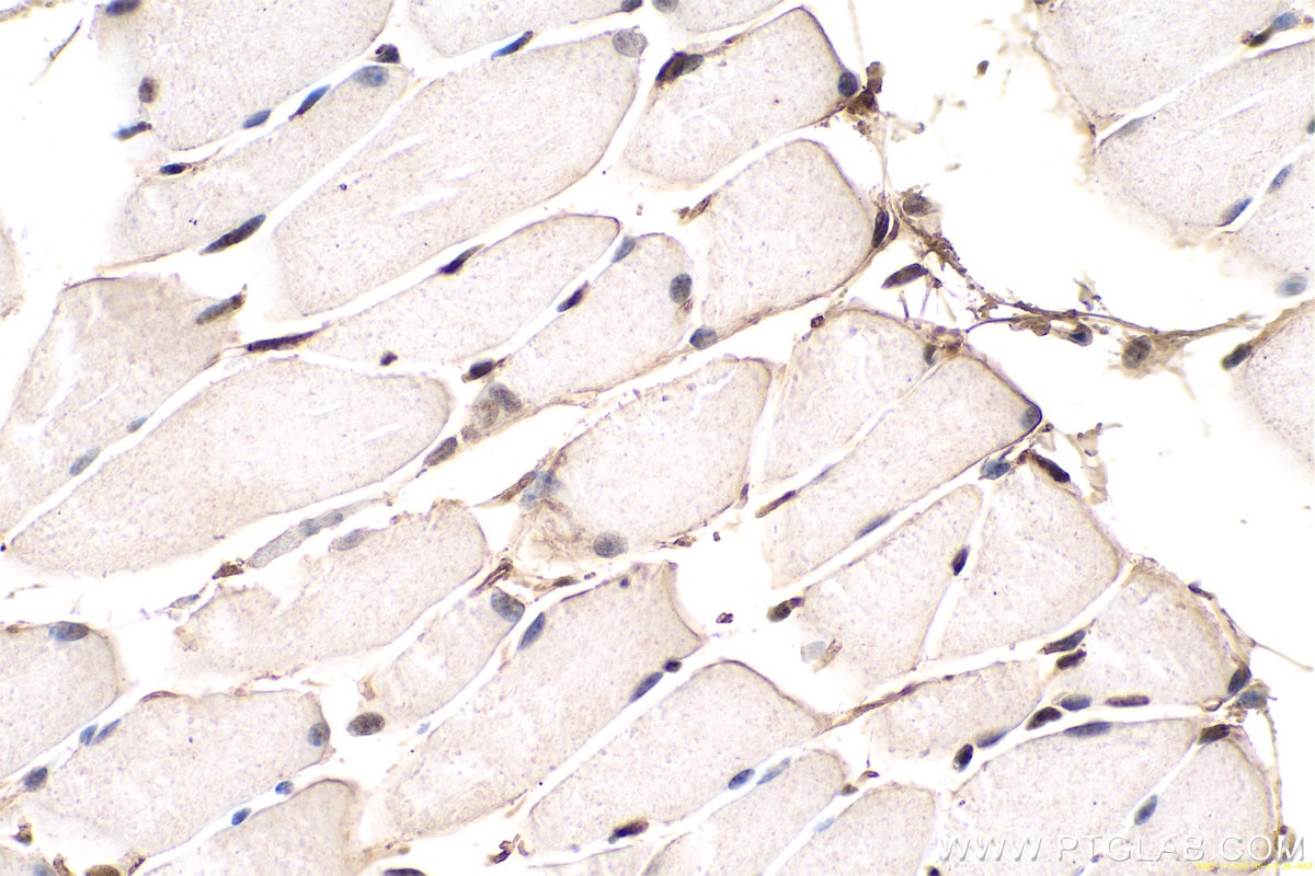 Immunohistochemical analysis of paraffin-embedded mouse skeletal muscle tissue slide using KHC0670 (ANP32A IHC Kit).