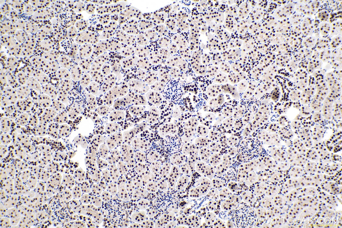 Immunohistochemical analysis of paraffin-embedded rat kidney tissue slide using KHC0670 (ANP32A IHC Kit).