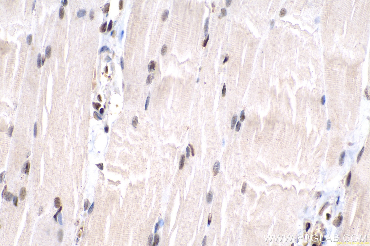 Immunohistochemical analysis of paraffin-embedded rat skeletal muscle tissue slide using KHC0670 (ANP32A IHC Kit).