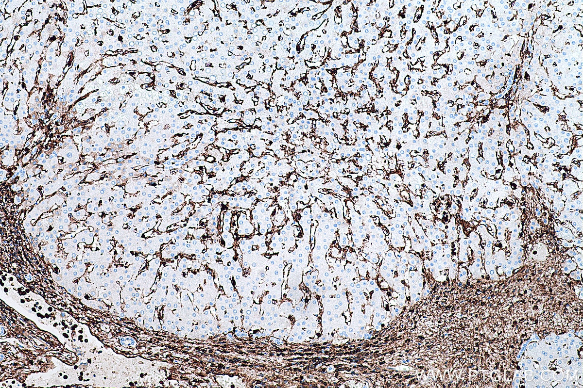 Immunohistochemical analysis of paraffin-embedded human liver tissue slide using KHC0399 (ANXA1 IHC Kit).