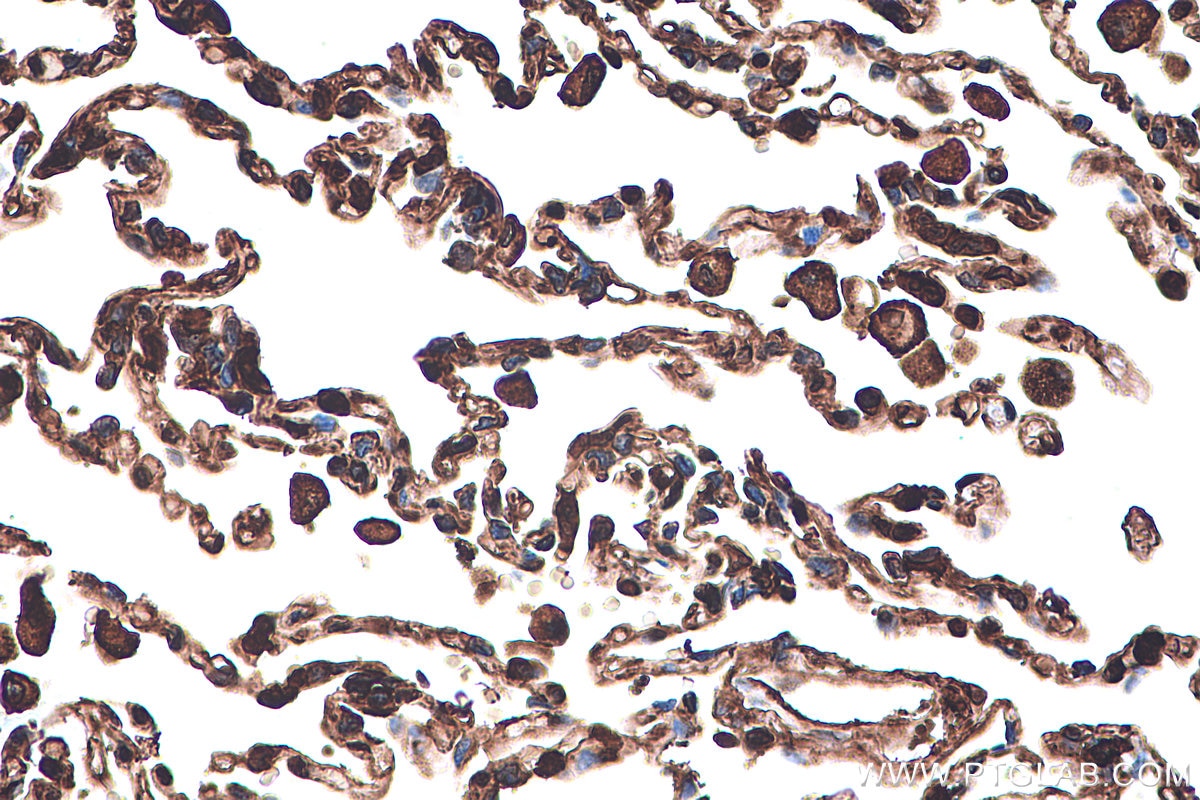 Immunohistochemical analysis of paraffin-embedded human lung tissue slide using KHC0399 (ANXA1 IHC Kit).