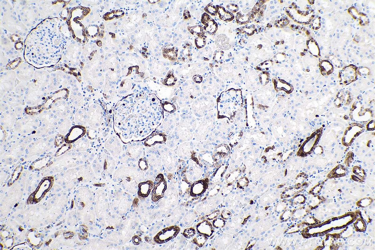 Immunohistochemical analysis of paraffin-embedded human kidney tissue slide using KHC0706 (ANXA3 IHC Kit).