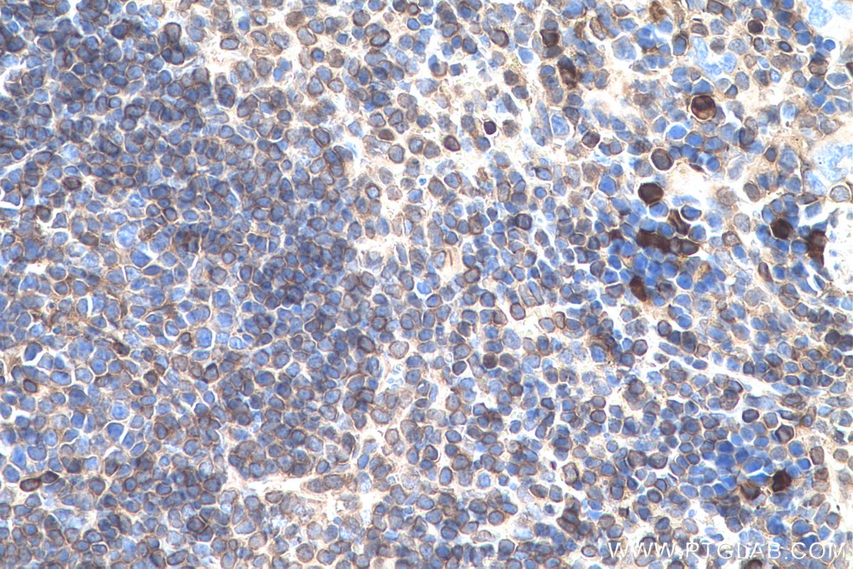 Immunohistochemical analysis of paraffin-embedded mouse spleen tissue slide using KHC0561 (ANXA6 IHC Kit).