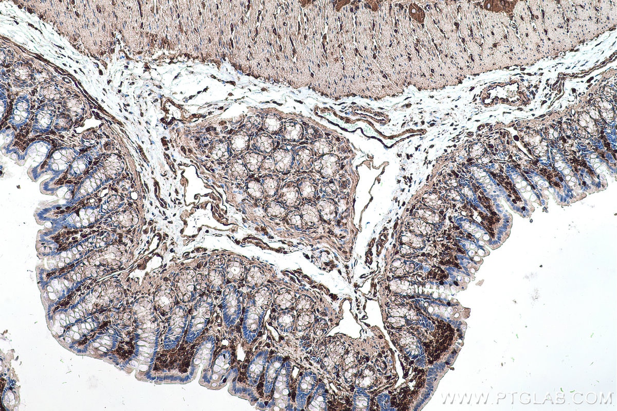 Immunohistochemical analysis of paraffin-embedded rat colon tissue slide using KHC0561 (ANXA6 IHC Kit).