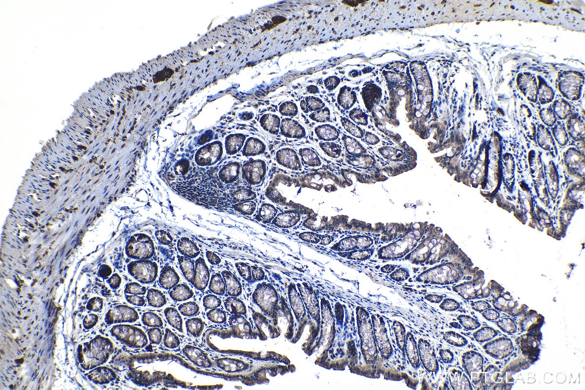 Immunohistochemical analysis of paraffin-embedded mouse colon tissue slide using KHC1273 (AP2A1 IHC Kit).