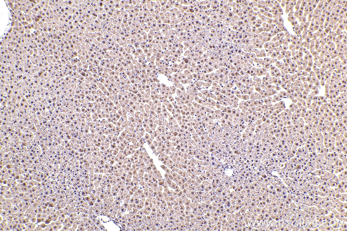 Immunohistochemical analysis of paraffin-embedded rat liver tissue slide using KHC2387 (APBA1 IHC Kit).