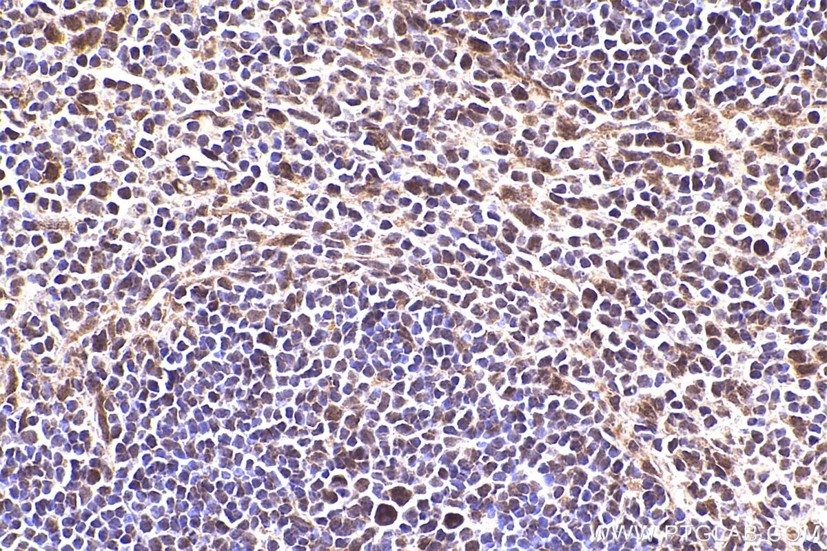 Immunohistochemical analysis of paraffin-embedded mouse spleen tissue slide using KHC2387 (APBA1 IHC Kit).