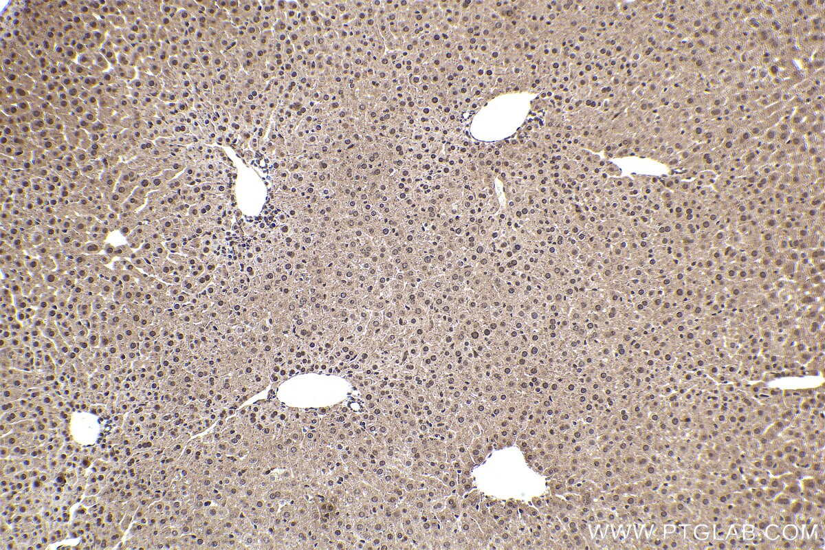Immunohistochemical analysis of paraffin-embedded mouse liver tissue slide using KHC2387 (APBA1 IHC Kit).