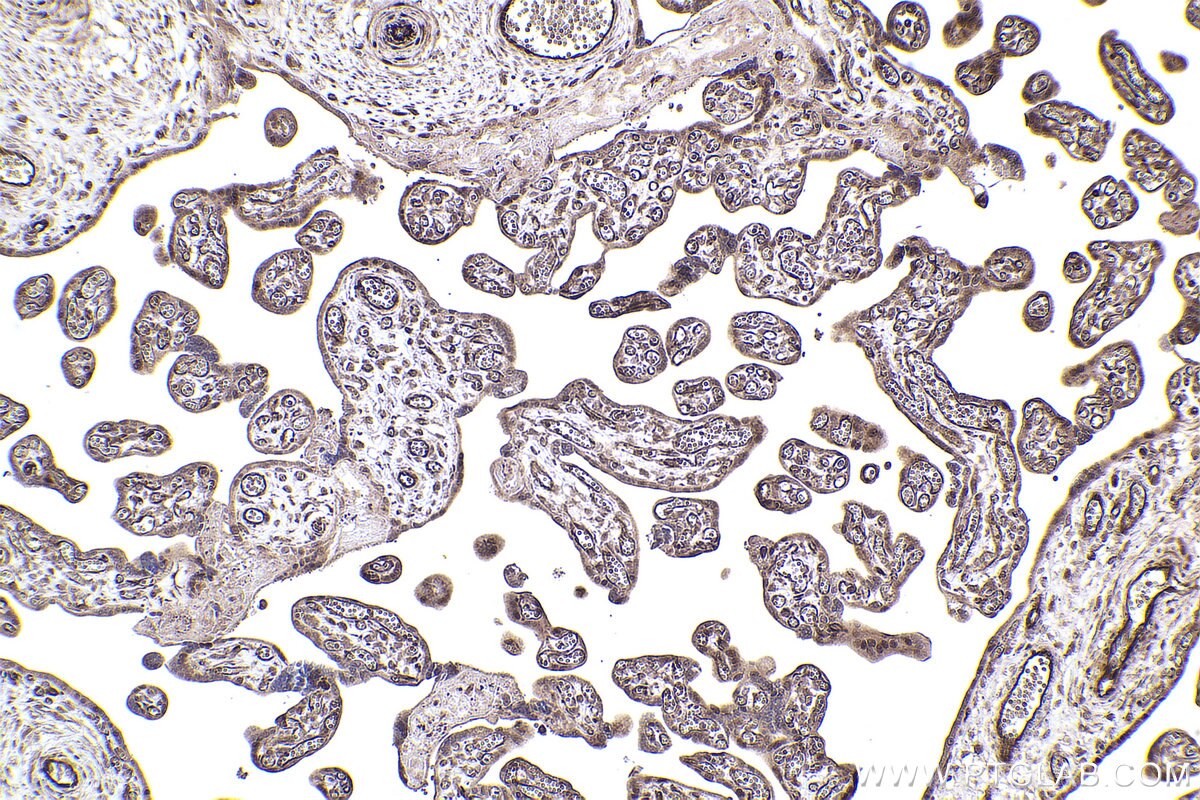 Immunohistochemical analysis of paraffin-embedded human placenta tissue slide using KHC2387 (APBA1 IHC Kit).