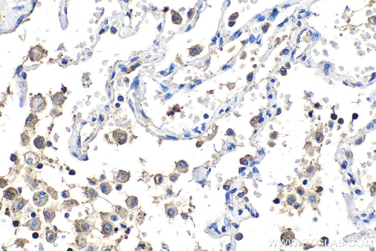 Immunohistochemical analysis of paraffin-embedded human lung tissue slide using KHC2041 (APBB1 IHC Kit).