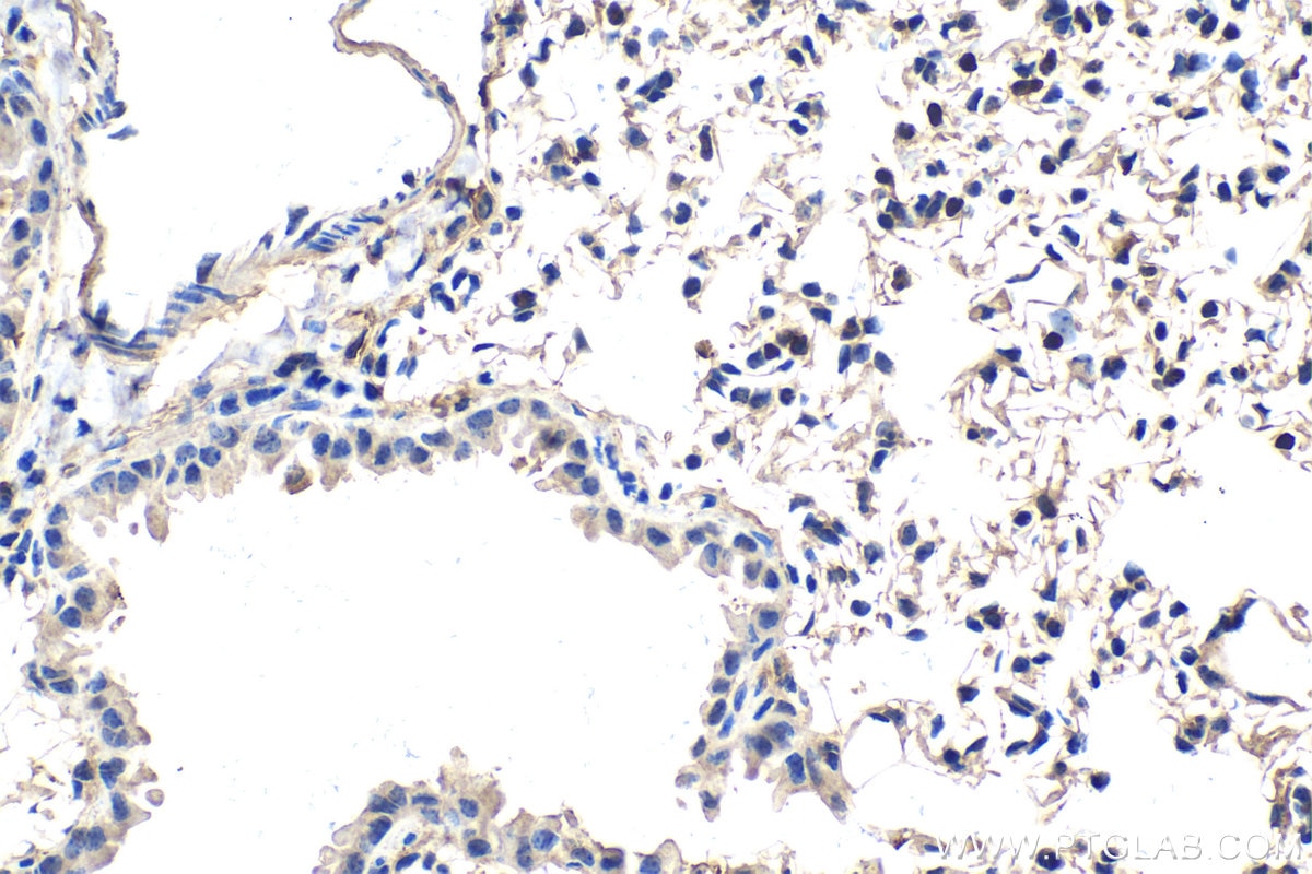 Immunohistochemical analysis of paraffin-embedded mouse lung tissue slide using KHC2041 (APBB1 IHC Kit).