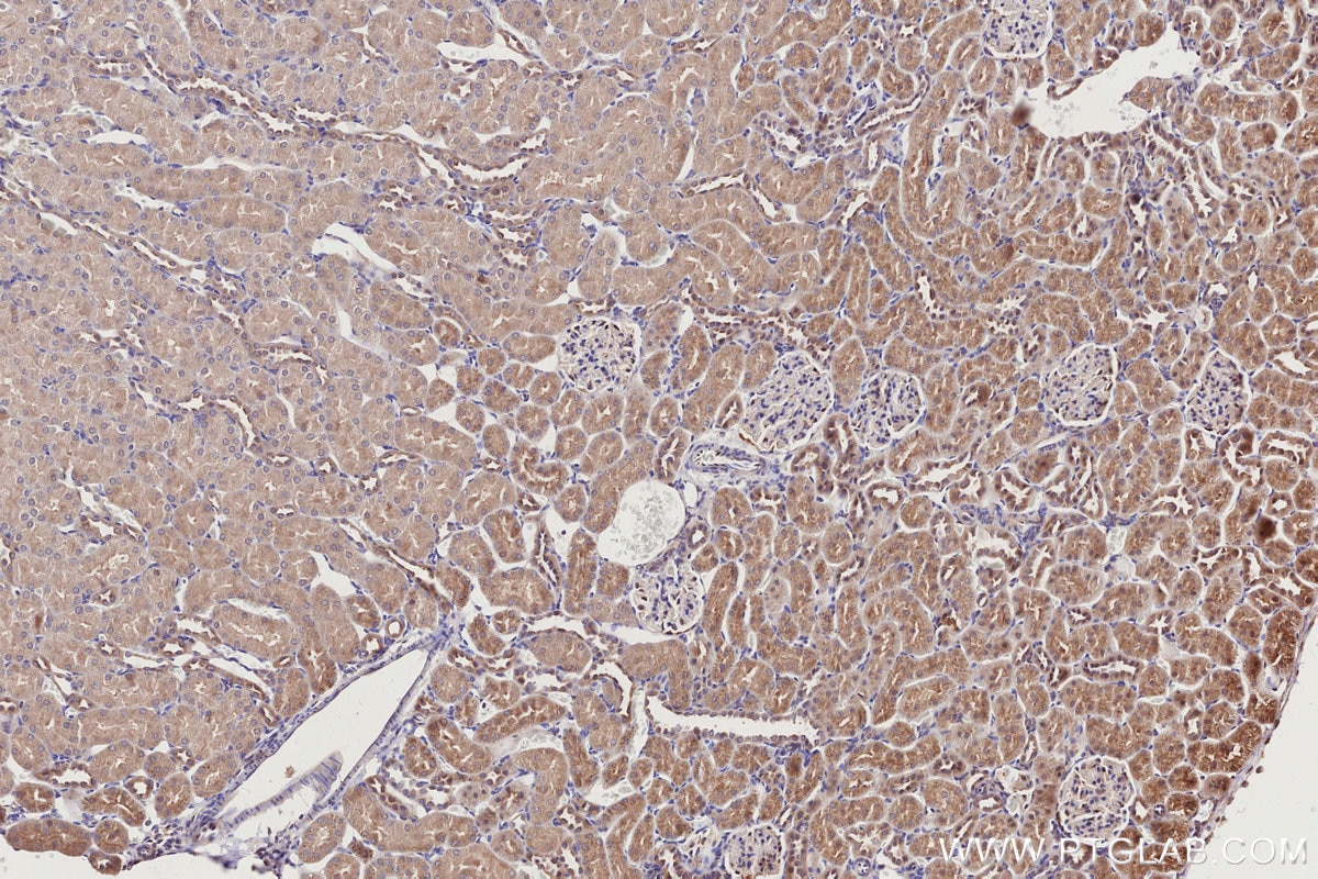 Immunohistochemical analysis of paraffin-embedded rat kidney tissue slide using KHC2762 (APBB2 IHC Kit).