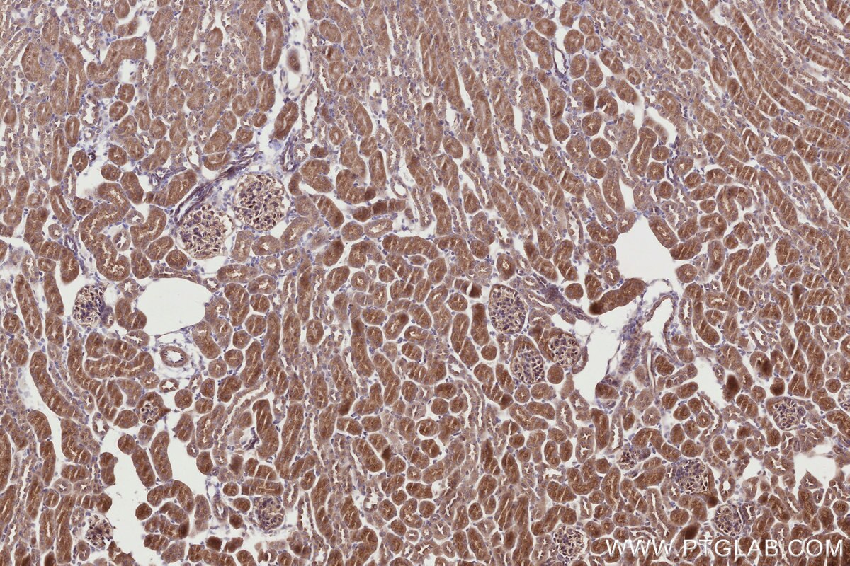 Immunohistochemical analysis of paraffin-embedded mouse kidney tissue slide using KHC2762 (APBB2 IHC Kit).