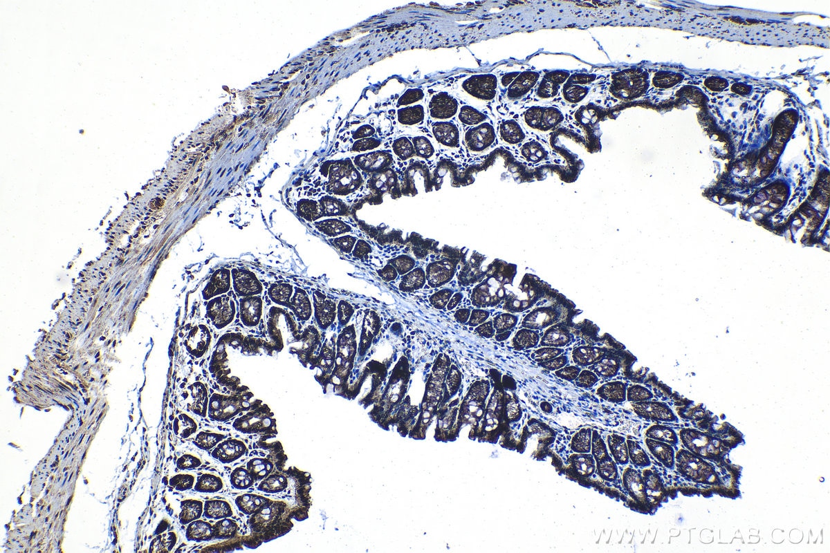 Immunohistochemical analysis of paraffin-embedded mouse colon tissue slide using KHC1351 (APC2 IHC Kit).