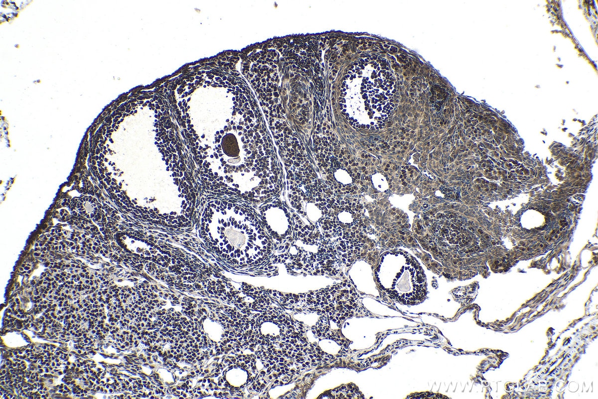 Immunohistochemical analysis of paraffin-embedded mouse ovary tissue slide using KHC1569 (APEX1 IHC Kit).