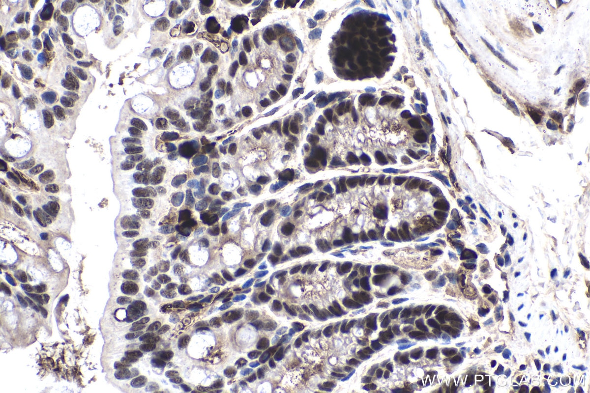 Immunohistochemical analysis of paraffin-embedded mouse colon tissue slide using KHC1569 (APEX1 IHC Kit).