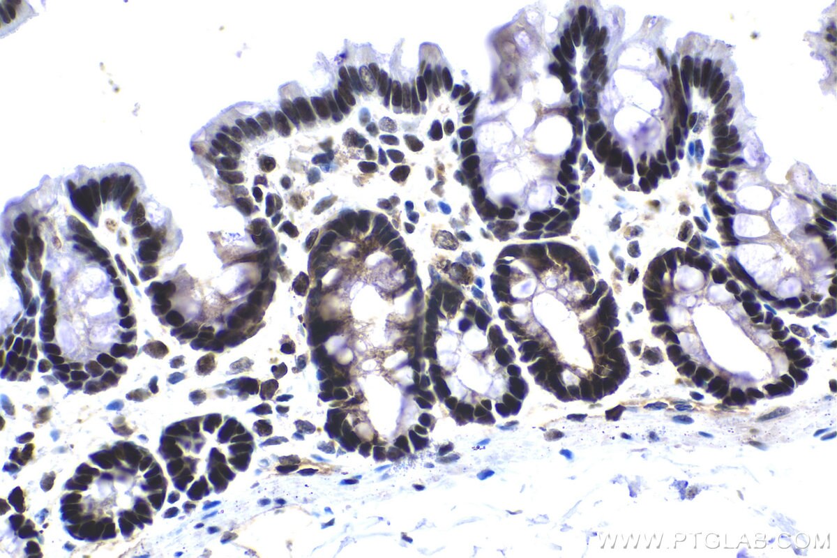 Immunohistochemical analysis of paraffin-embedded rat colon tissue slide using KHC1569 (APEX1 IHC Kit).