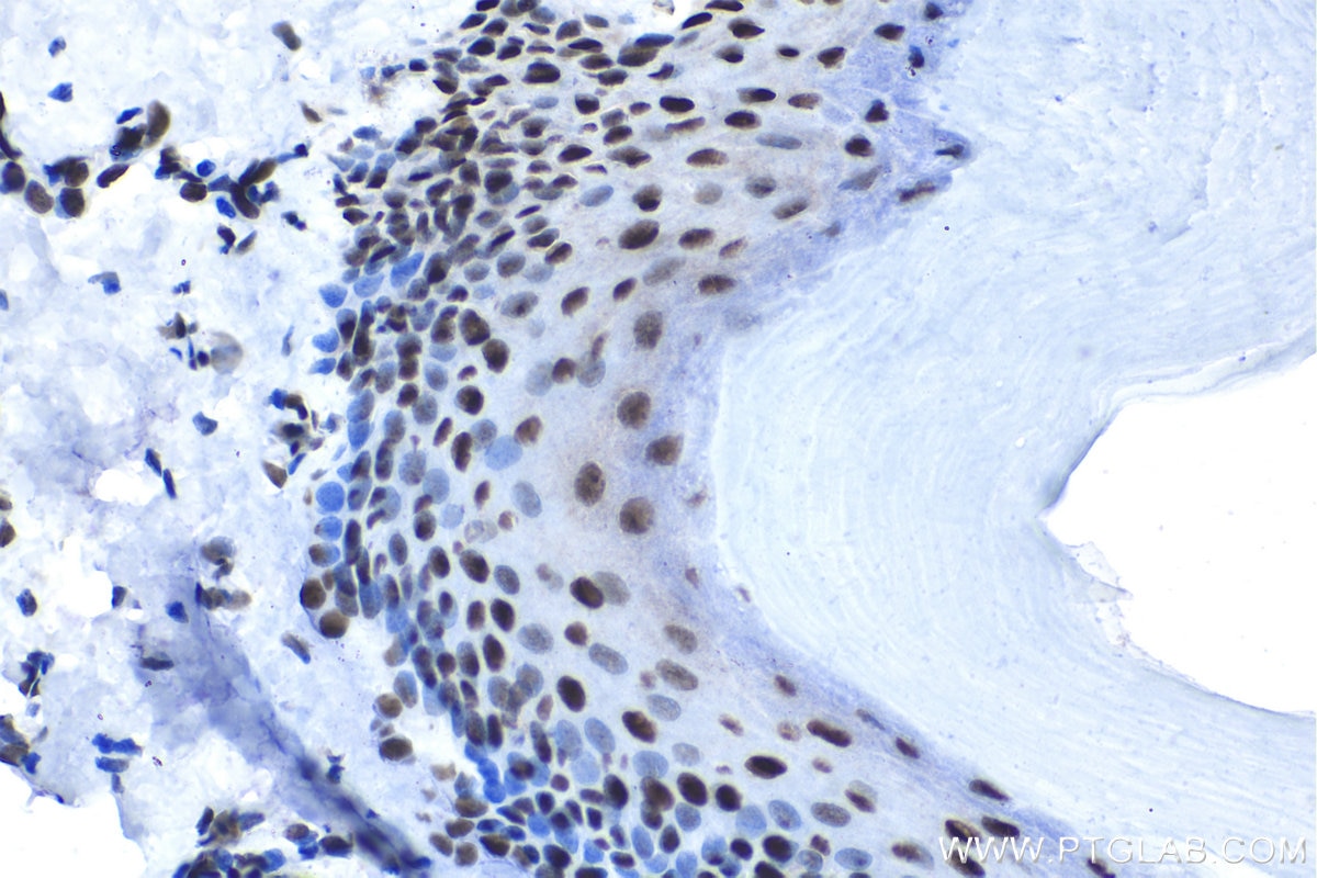 Immunohistochemical analysis of paraffin-embedded rat skin tissue slide using KHC1569 (APEX1 IHC Kit).