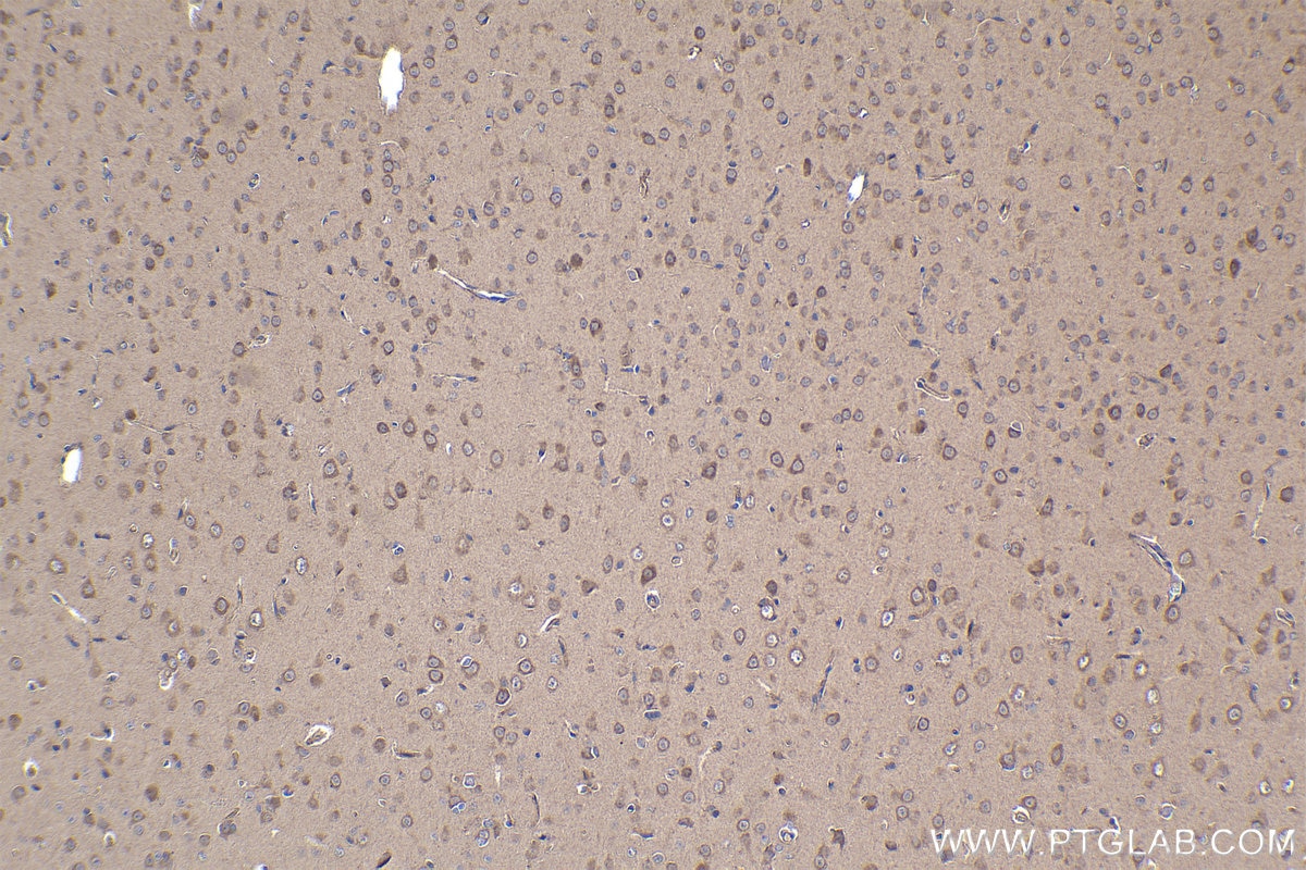 Immunohistochemical analysis of paraffin-embedded rat brain tissue slide using KHC1114 (APLP2 IHC Kit).