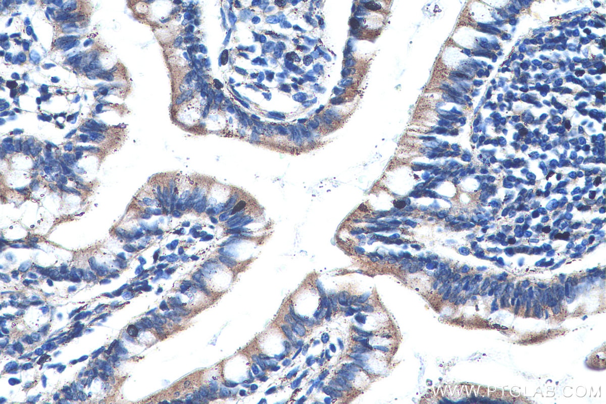 Immunohistochemical analysis of paraffin-embedded human small intestine tissue slide using KHC0491 (APOA1 IHC Kit).