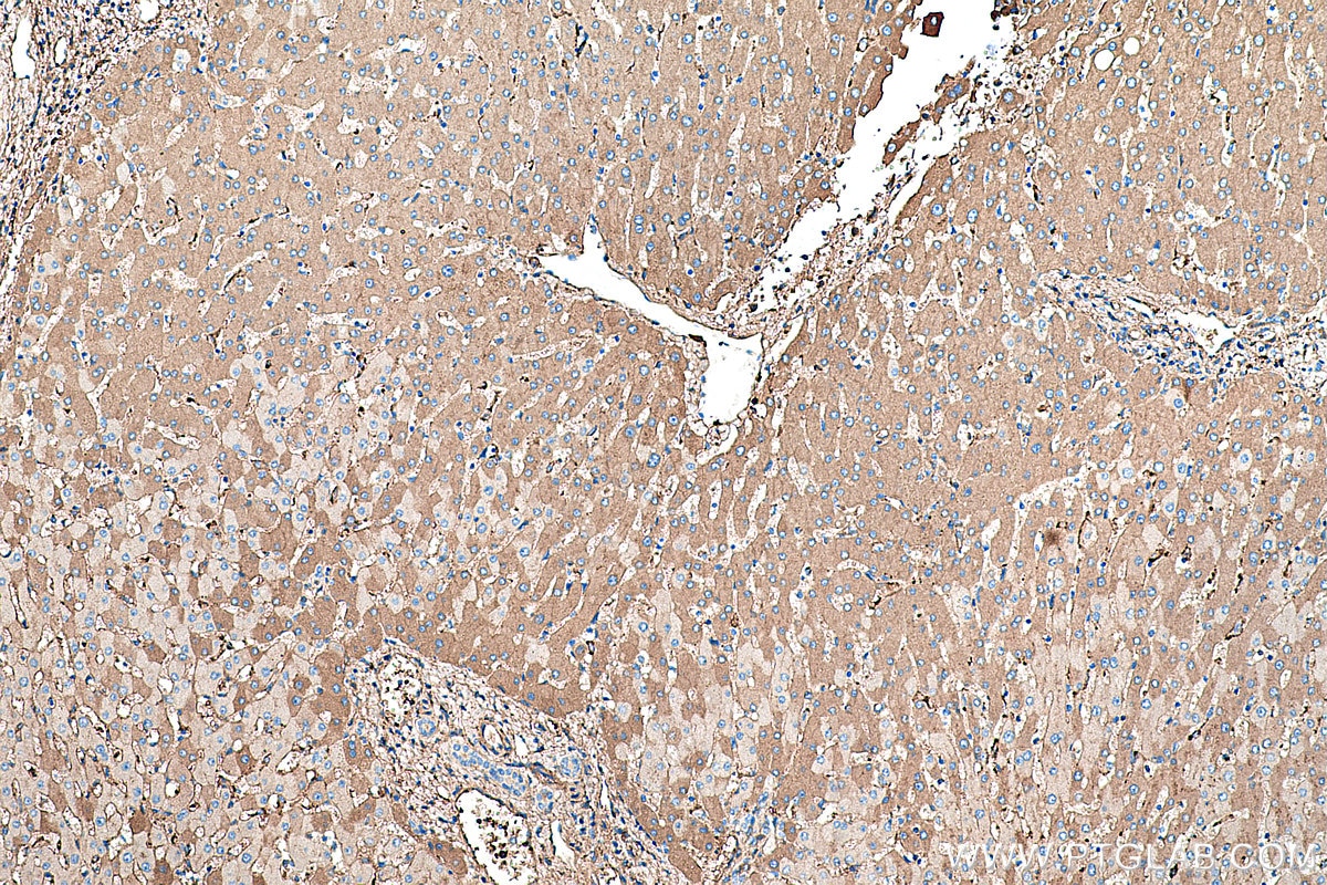 Immunohistochemical analysis of paraffin-embedded human liver tissue slide using KHC0381 (APOA2 IHC Kit).