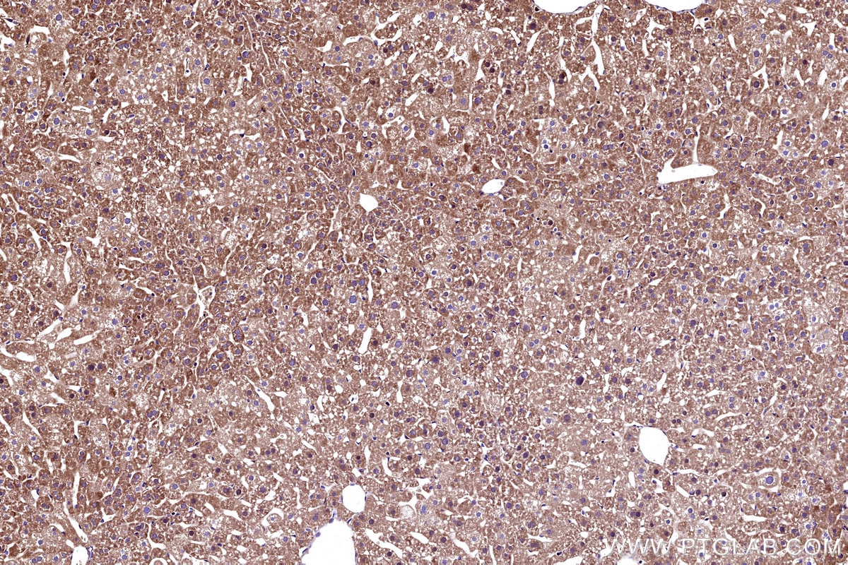 Immunohistochemical analysis of paraffin-embedded mouse liver tissue slide using KHC3167 (APOB IHC Kit).