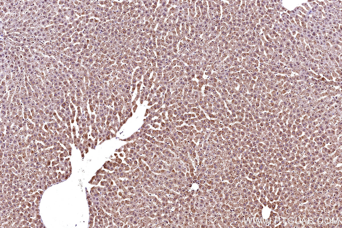Immunohistochemical analysis of paraffin-embedded rat liver tissue slide using KHC3167 (APOB IHC Kit).