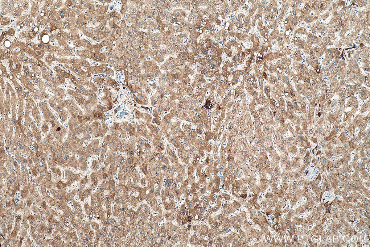 Immunohistochemical analysis of paraffin-embedded human liver tissue slide using KHC0492 (APOC1 IHC Kit).