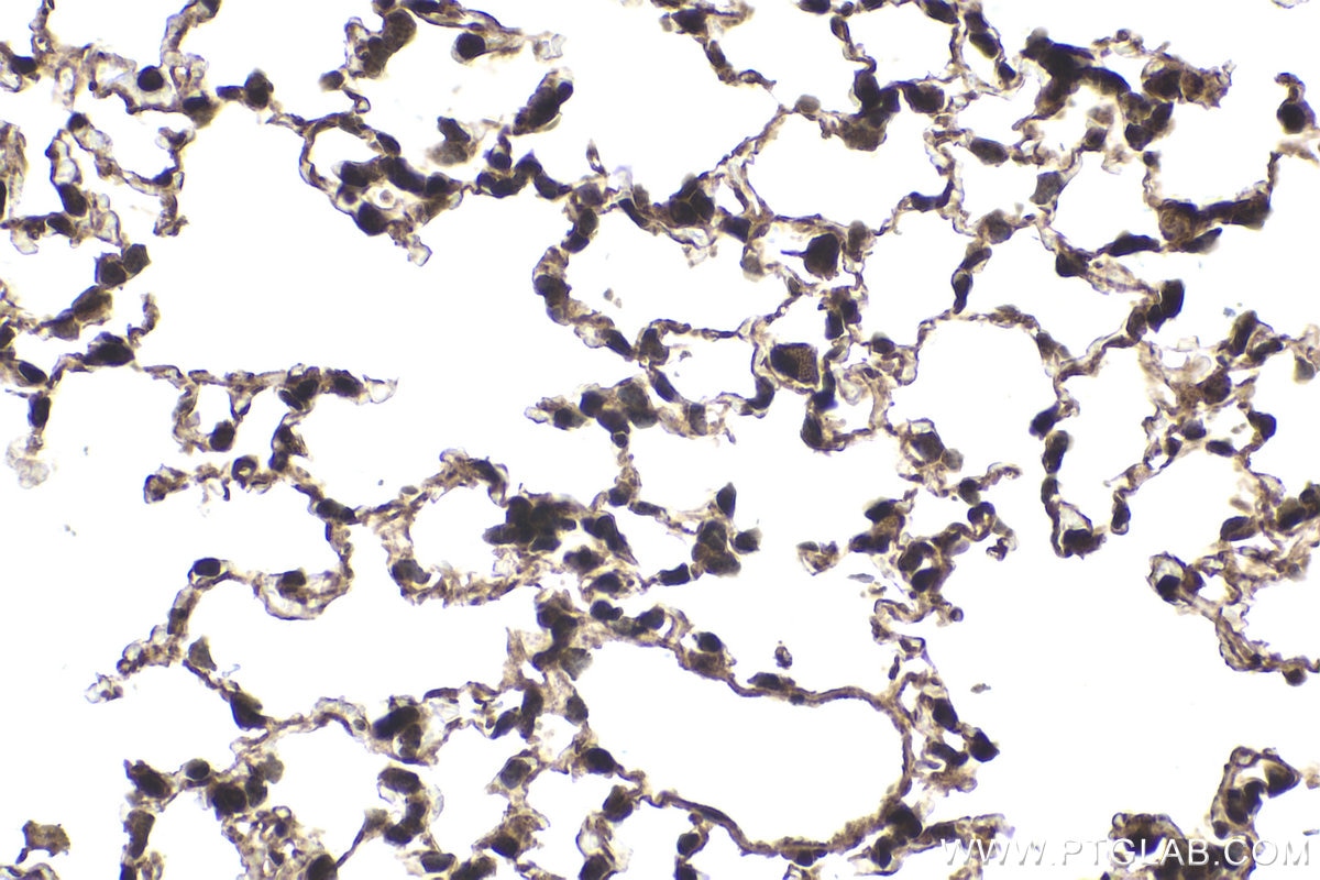 Immunohistochemical analysis of paraffin-embedded mouse lung tissue slide using KHC1837 (APPL2 IHC Kit).