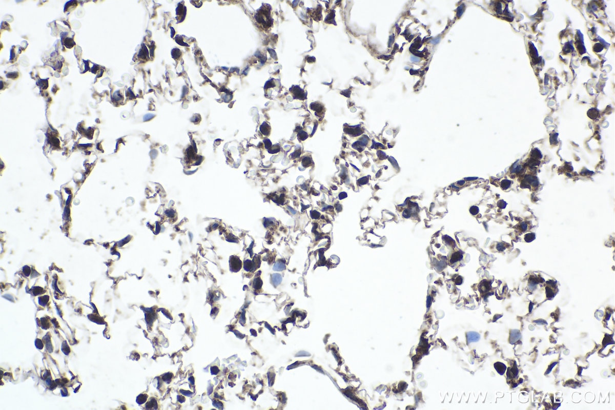 Immunohistochemical analysis of paraffin-embedded rat lung tissue slide using KHC1837 (APPL2 IHC Kit).