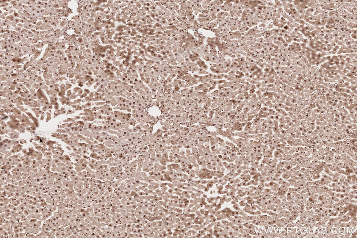 Immunohistochemical analysis of paraffin-embedded rat liver tissue slide using KHC2617 (APTX IHC Kit).