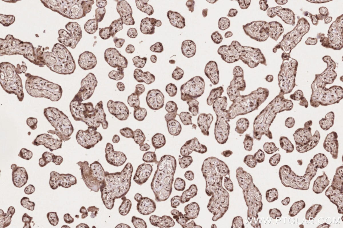 Immunohistochemical analysis of paraffin-embedded human placenta tissue slide using KHC2617 (APTX IHC Kit).