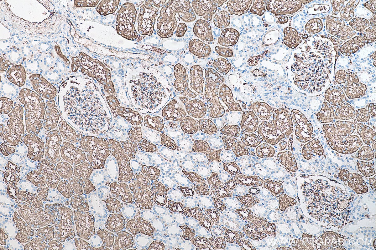 Immunohistochemical analysis of paraffin-embedded human kidney tissue slide using KHC0083 (AQP1 IHC Kit).