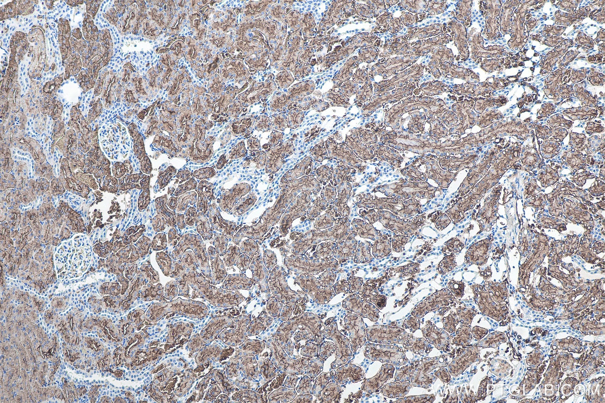 Immunohistochemical analysis of paraffin-embedded rat kidney tissue slide using KHC0083 (AQP1 IHC Kit).