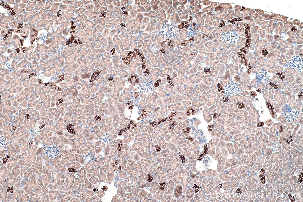 Immunohistochemical analysis of paraffin-embedded mouse kidney tissue slide using KHC0198 (AQP2 IHC Kit).