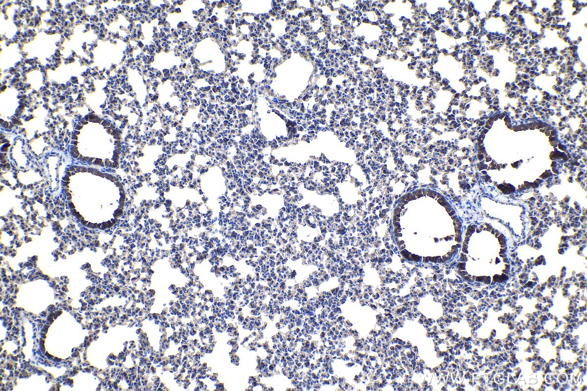 Immunohistochemical analysis of paraffin-embedded mouse lung tissue slide using KHC1094 (AQP5 IHC Kit).
