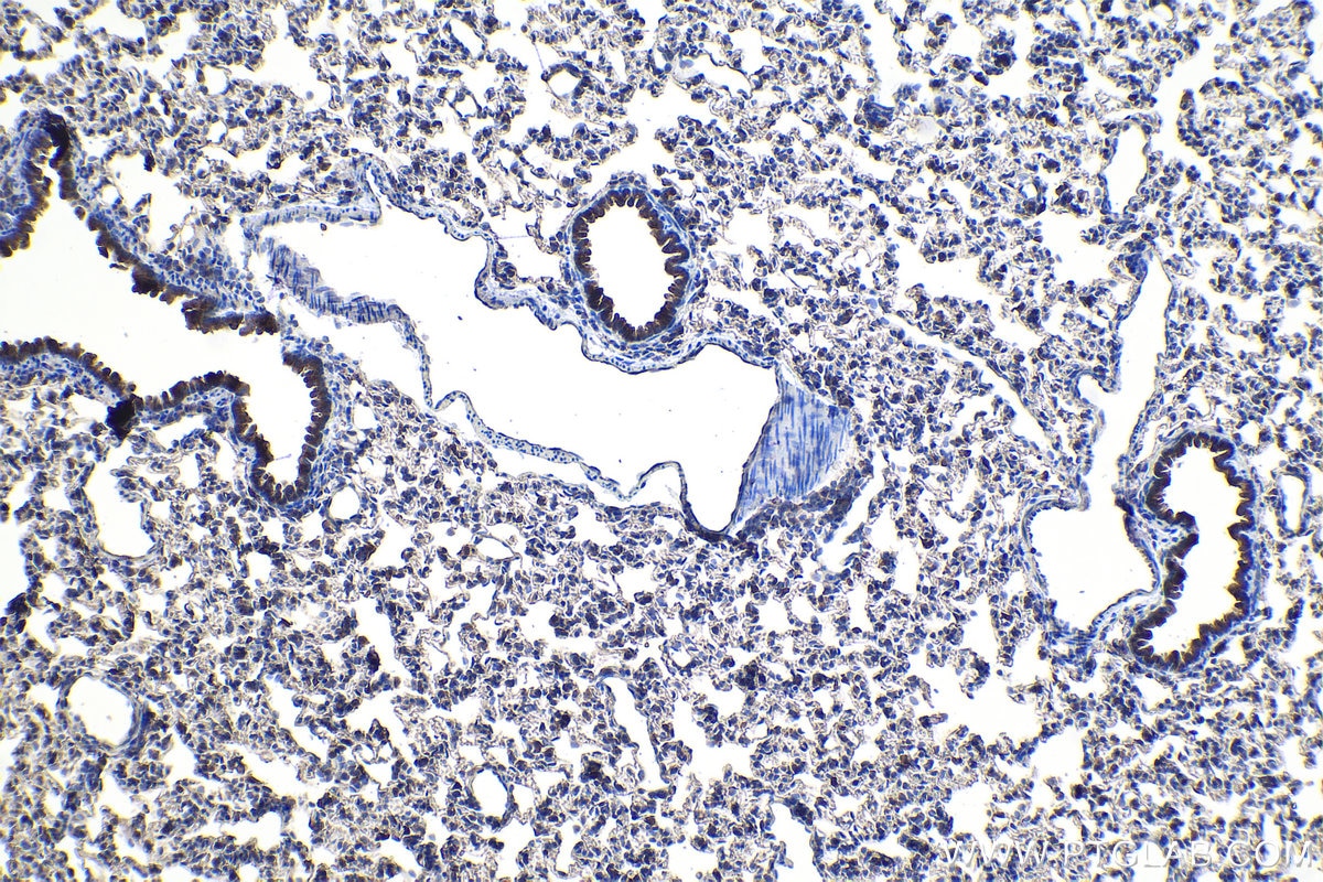 Immunohistochemical analysis of paraffin-embedded rat lung tissue slide using KHC1094 (AQP5 IHC Kit).