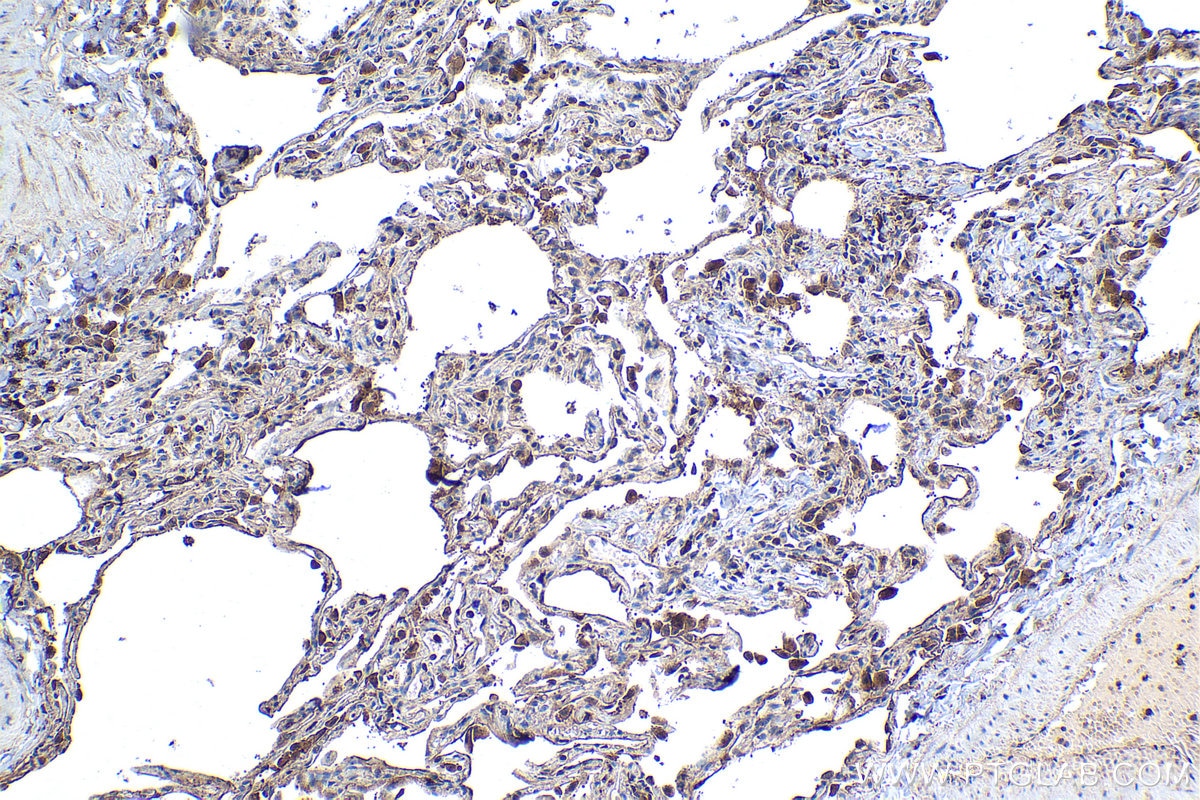 Immunohistochemical analysis of paraffin-embedded human lung tissue slide using KHC1094 (AQP5 IHC Kit).