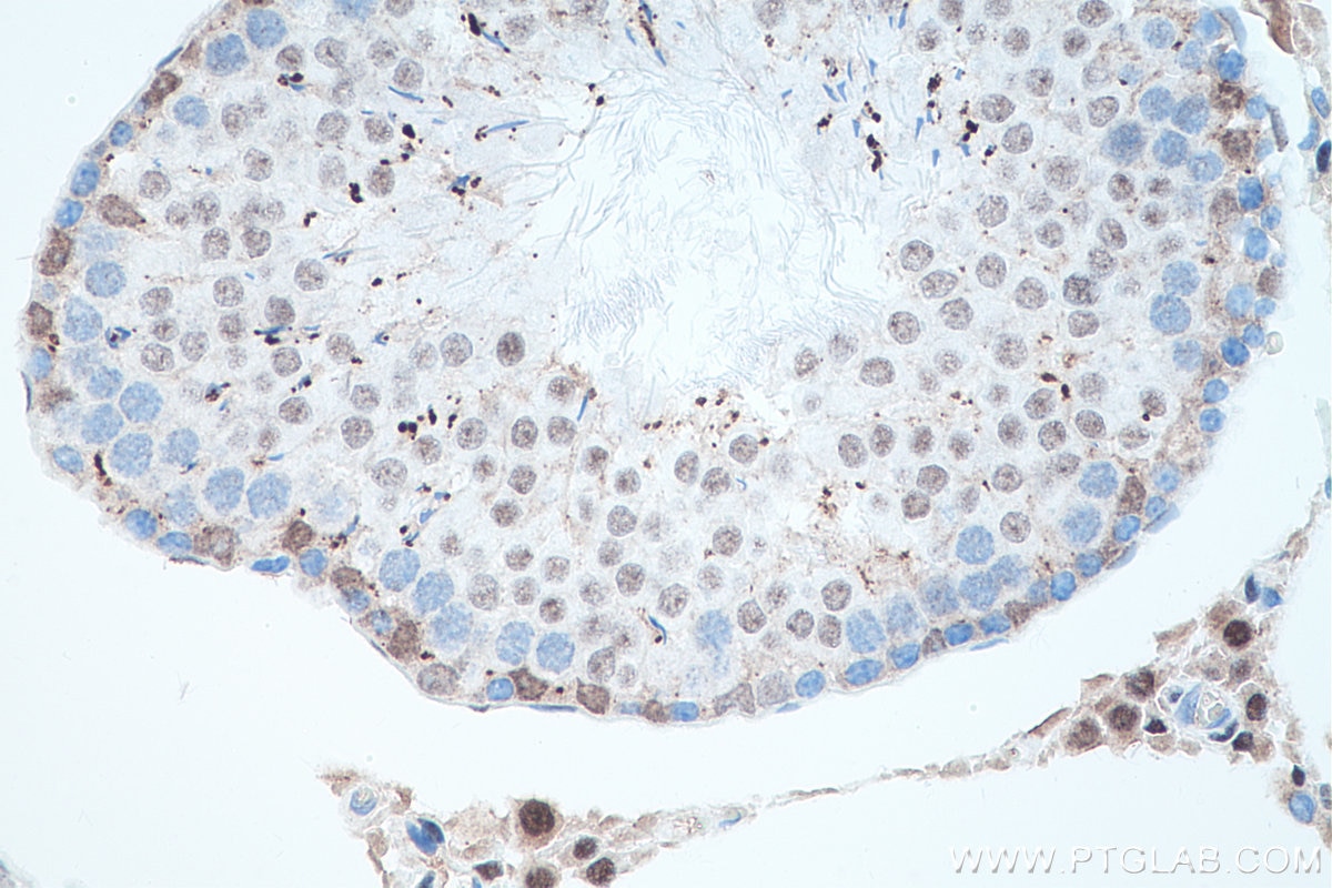 Immunohistochemical analysis of paraffin-embedded rat testis tissue slide using KHC0097 (AR IHC Kit).