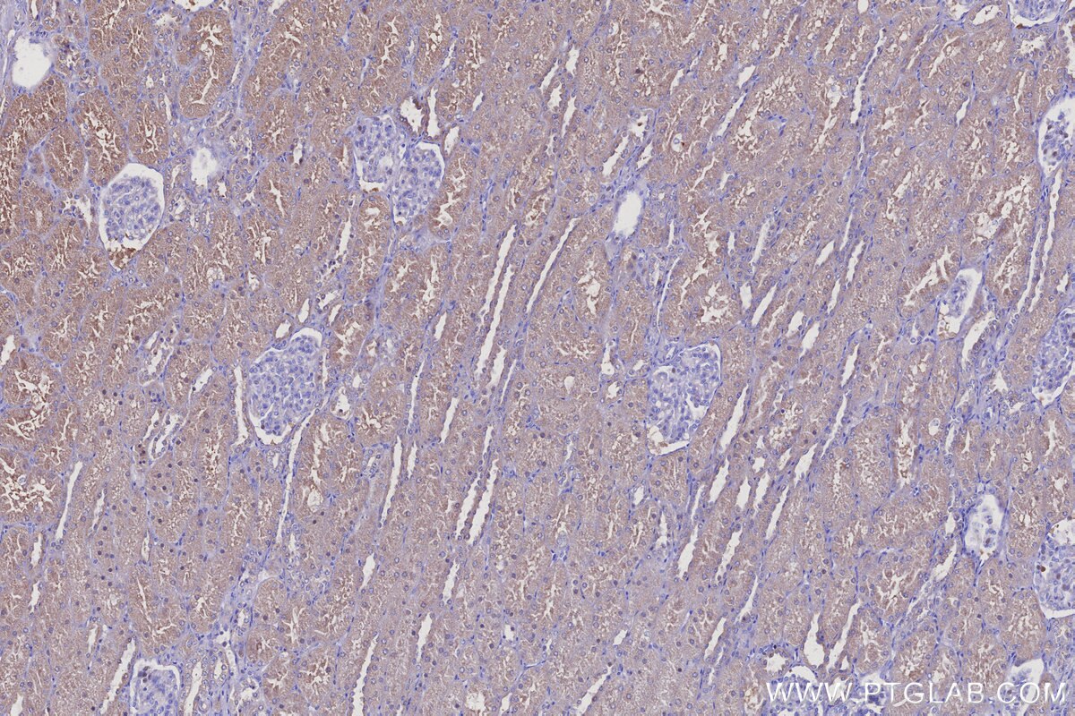Immunohistochemical analysis of paraffin-embedded human kidney tissue slide using KHC3109 (ARAP2 IHC Kit). Immunohistochemical analysis of paraffin-embedded human kidney tissue slide using KHC3109 (ARAP2 IHC Kit).