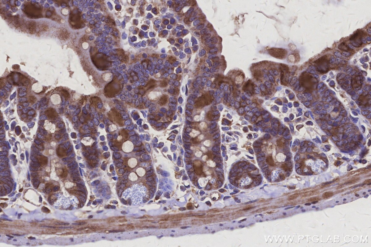 Immunohistochemical analysis of paraffin-embedded mouse small intestine tissue slide using KHC3109 (ARAP2 IHC Kit). Immunohistochemical analysis of paraffin-embedded mouse small intestine tissue slide using KHC3109 (ARAP2 IHC Kit).